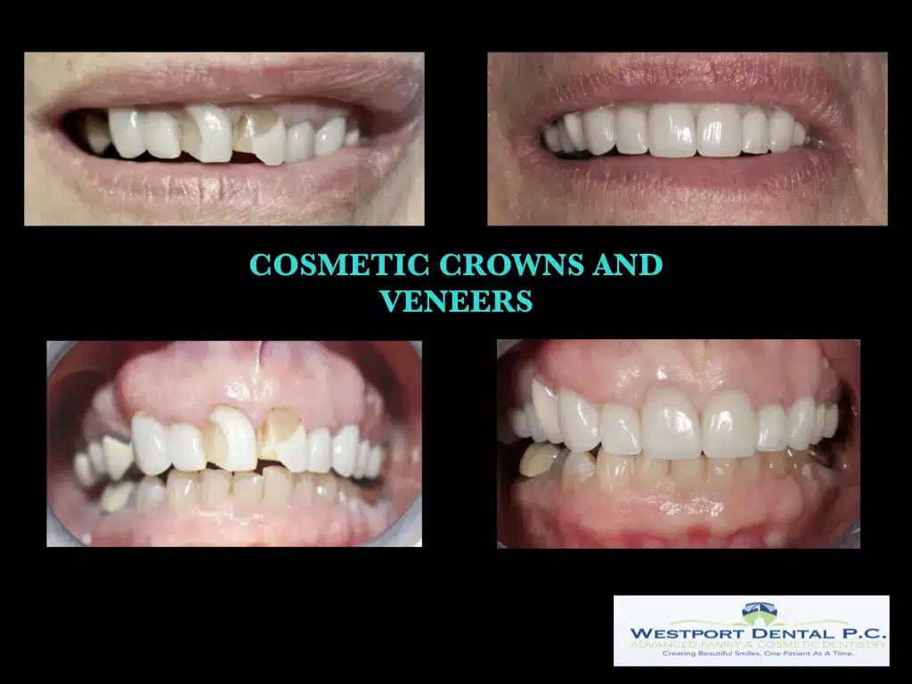 cosmetic-dentistry001.jpg