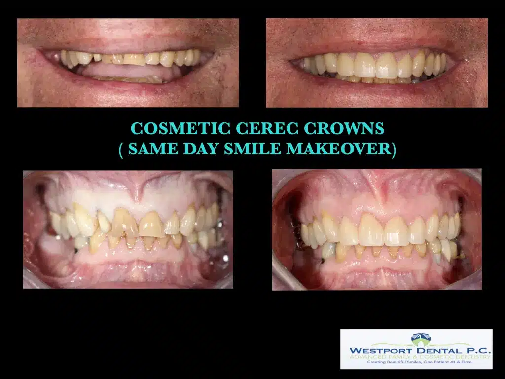 cosmetic-dentistry002.jpg