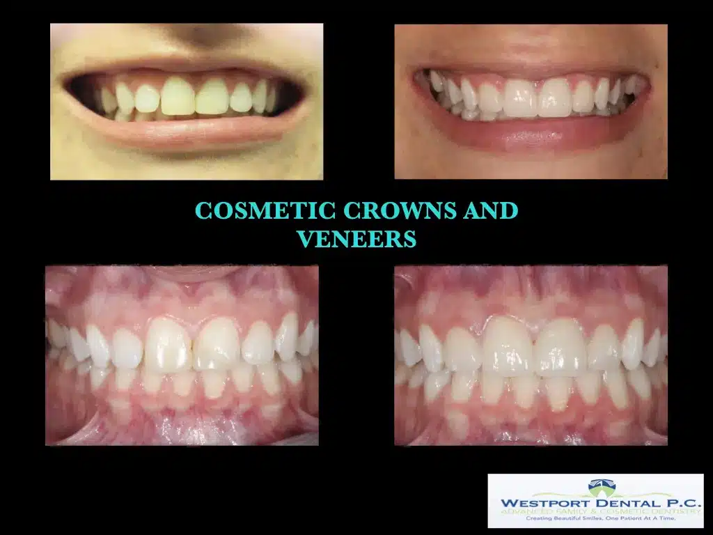 cosmetic-dentistry003.jpg