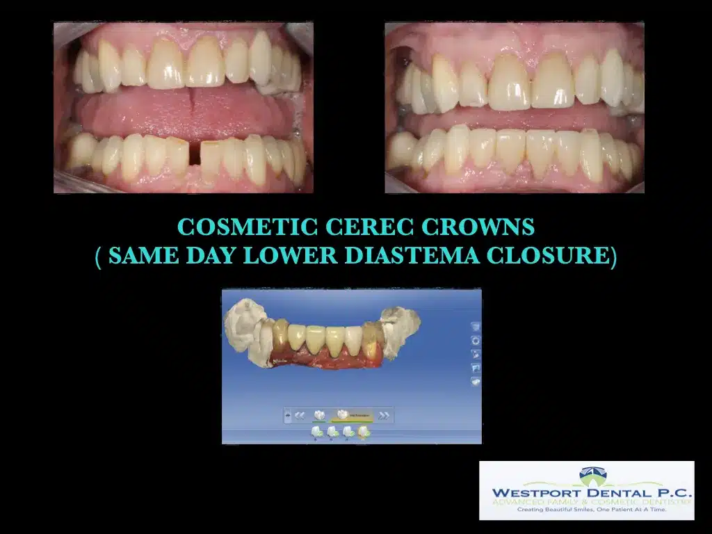 cosmetic-dentistry004.jpg