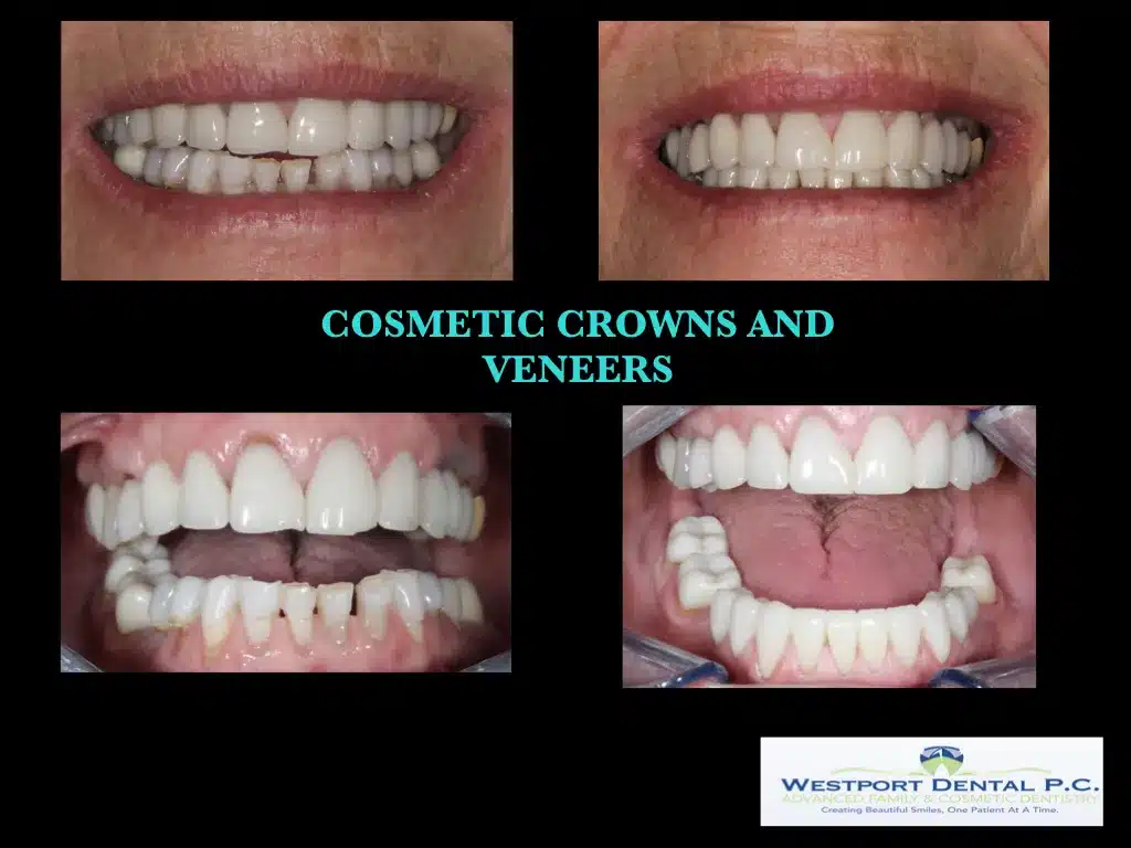 cosmetic-dentistry005.jpg