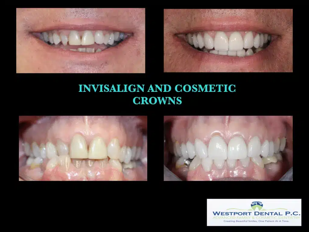 cosmetic-dentistry006.jpg