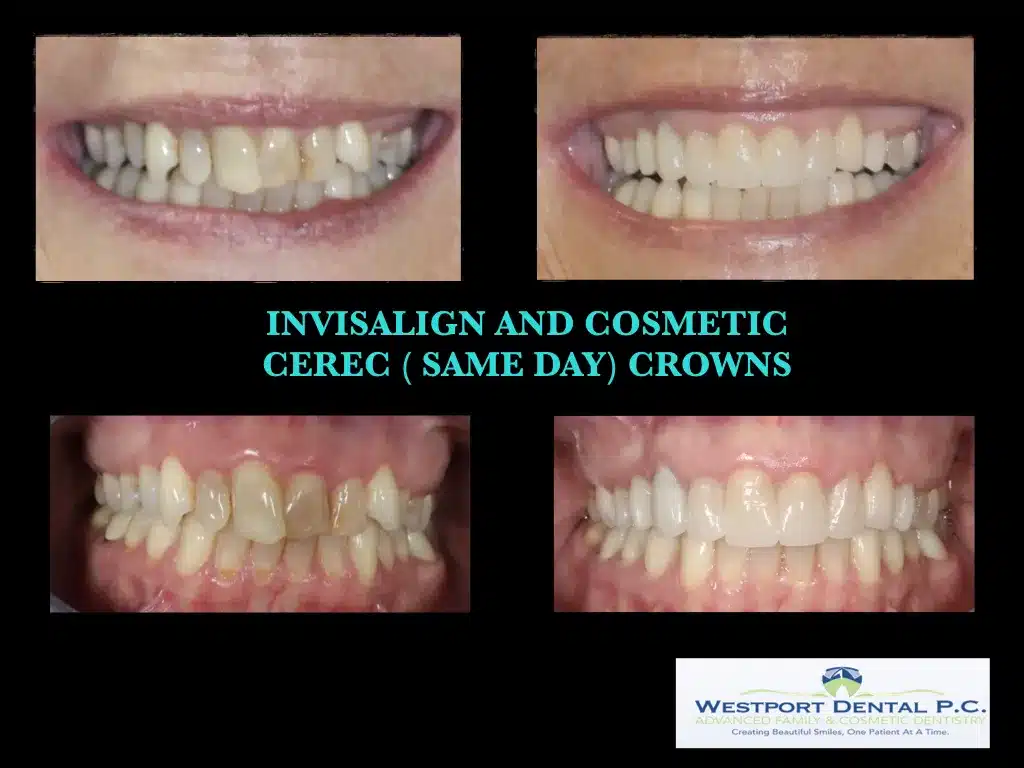 cosmetic-dentistry007.jpg