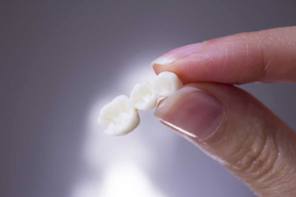 Cerec Same Day Crowns westport CEREC® same day crowns and bridges