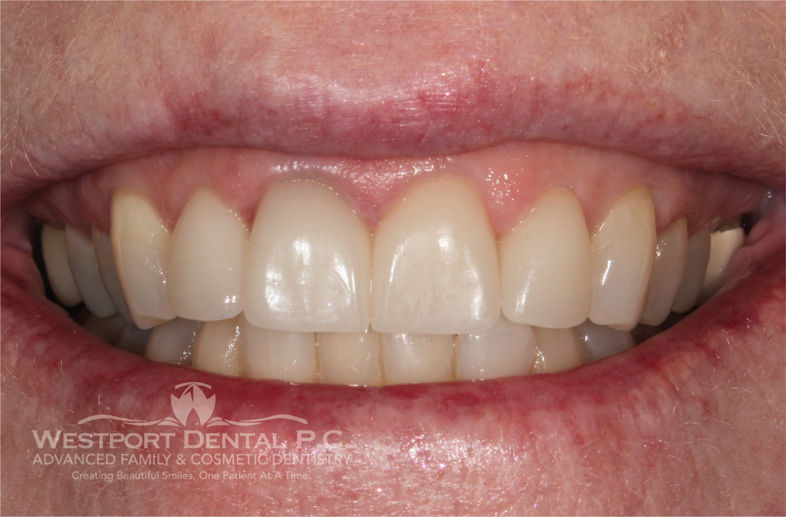 Smile Gallery Westport Dental Dentist in Westport, MA 02790