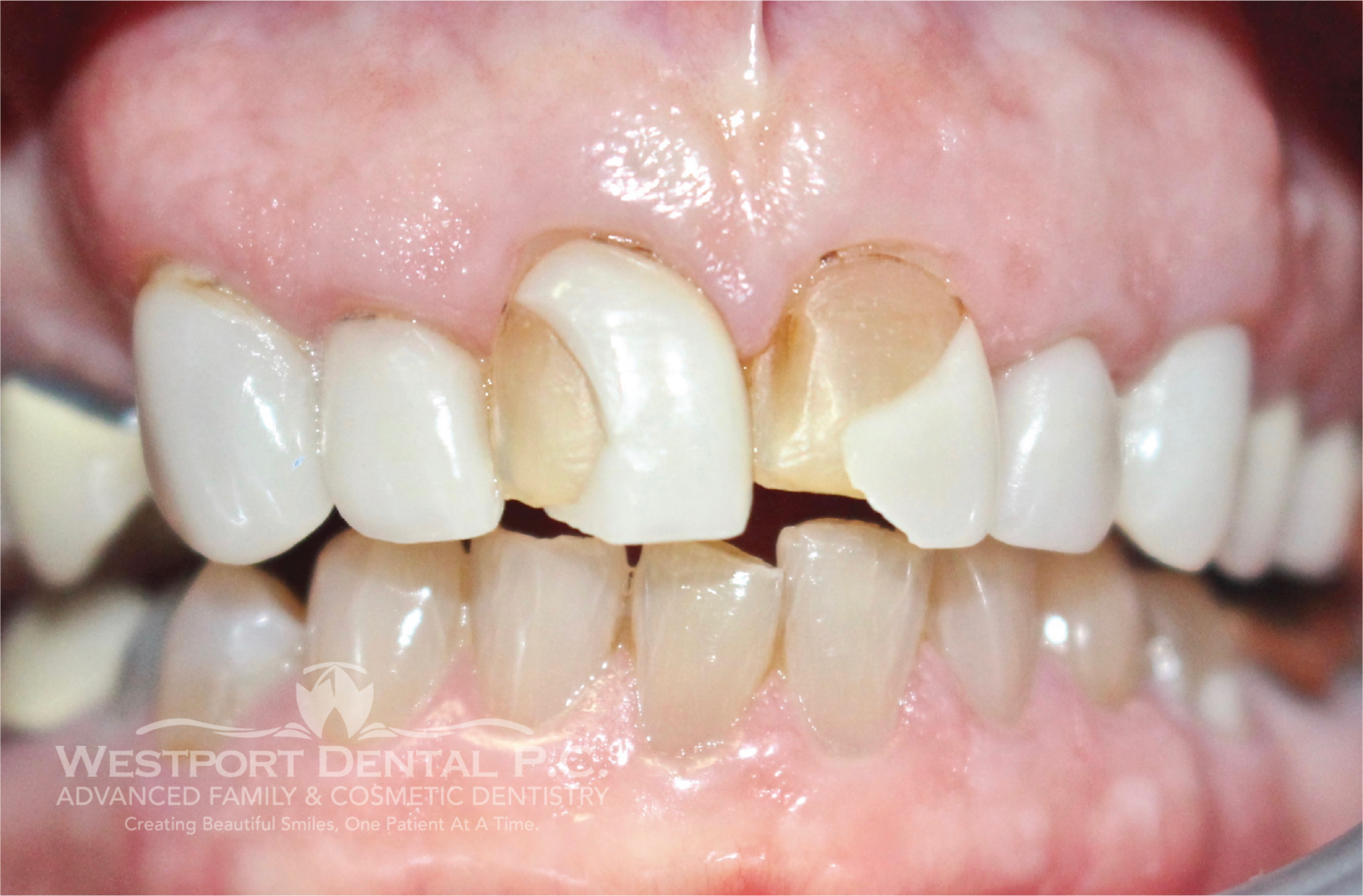 Smile Gallery Westport Dental Dentist in Westport, MA 02790