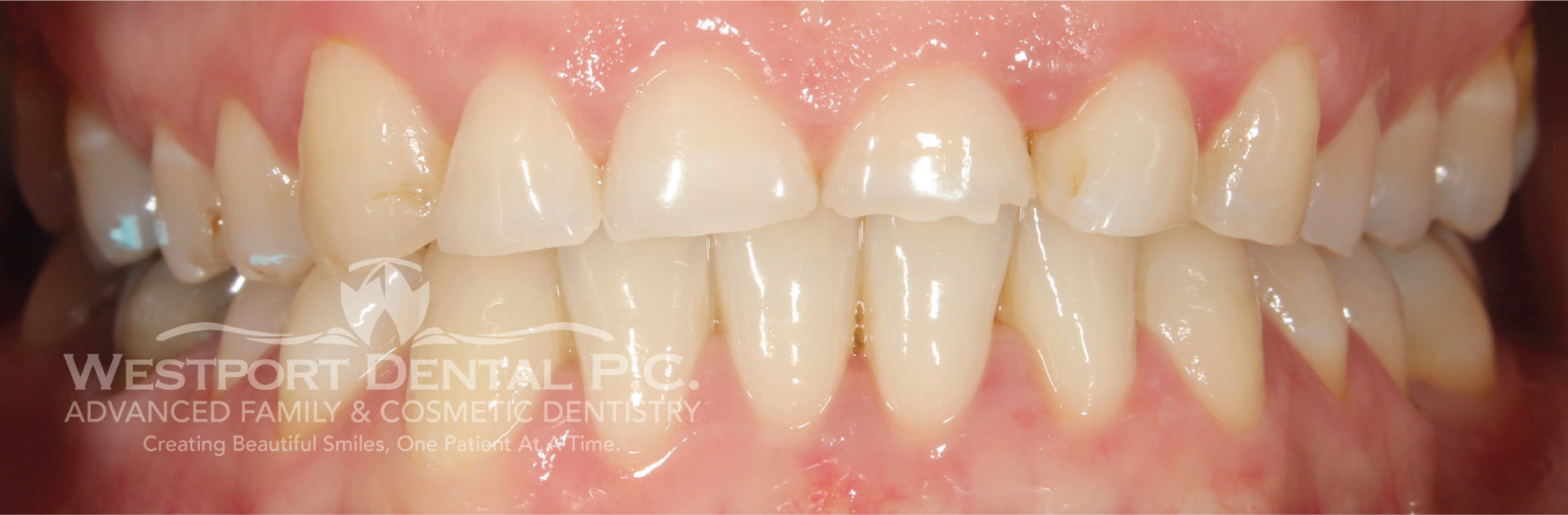 Smile Gallery Westport Dental Dentist in Westport, MA 02790