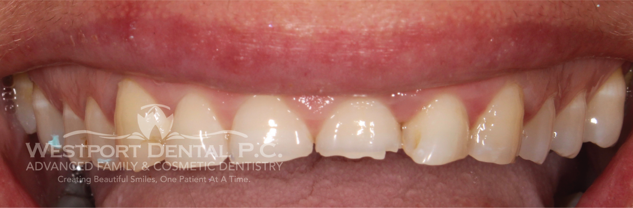 Smile Gallery Westport Dental Dentist in Westport, MA 02790
