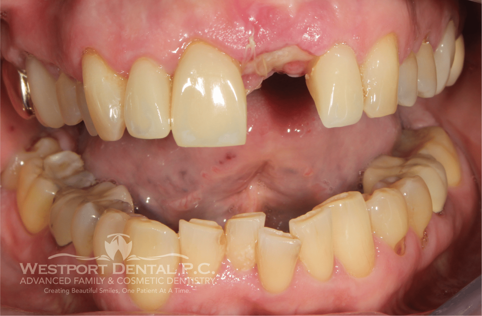 Smile Gallery Westport Dental Dentist in Westport, MA 02790