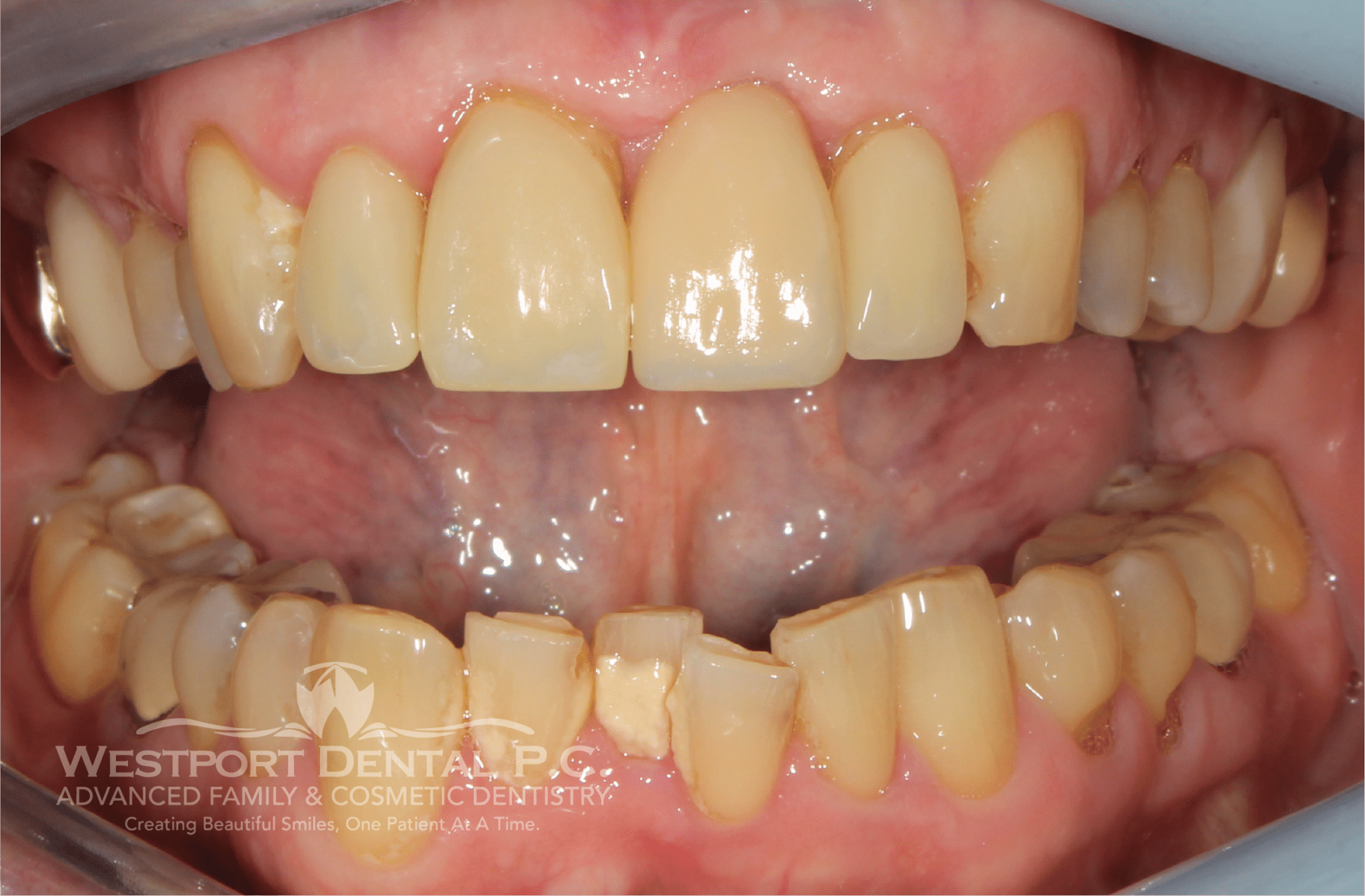 Smile Gallery Westport Dental Dentist in Westport, MA 02790