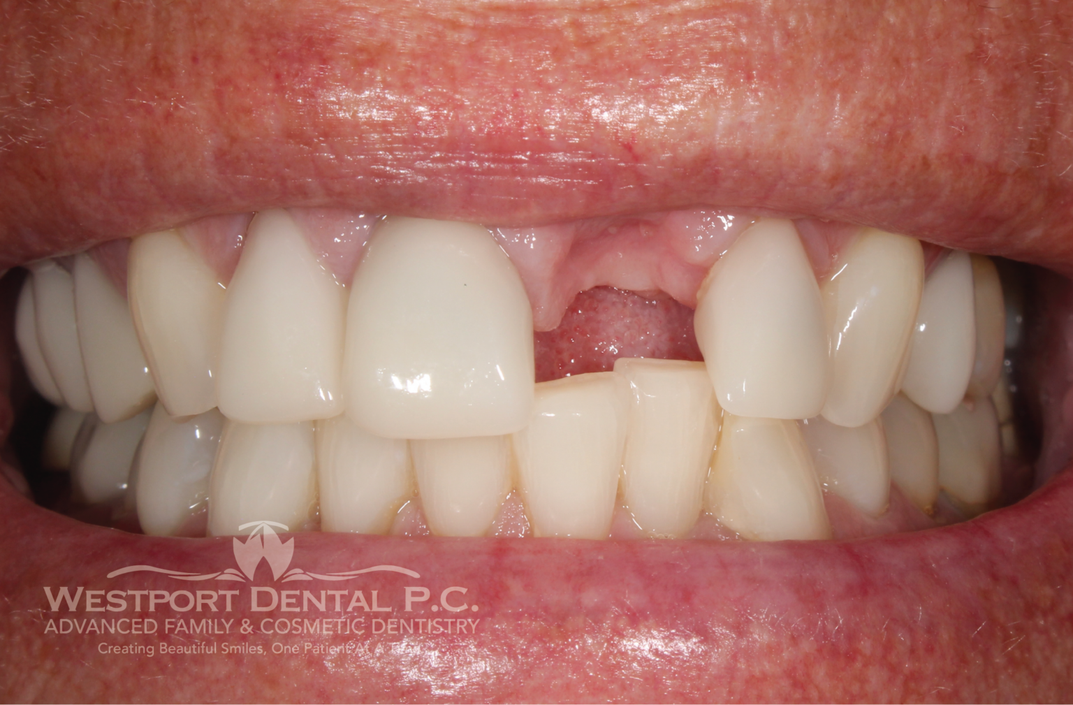 Smile Gallery Westport Dental Dentist in Westport, MA 02790