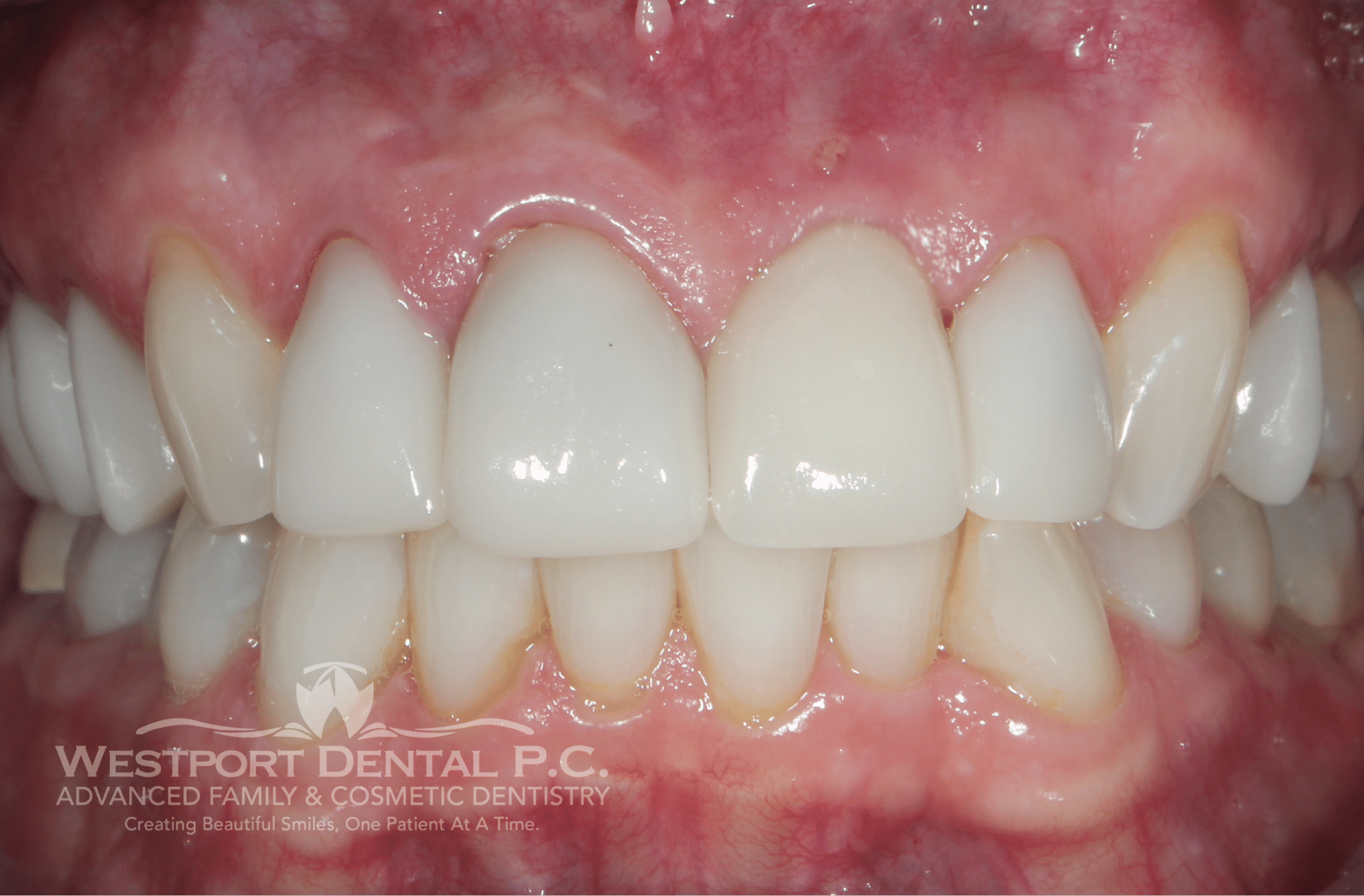 Smile Gallery Westport Dental Dentist in Westport, MA 02790